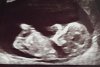 baby 11 weken.jpg