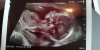 IMG-20191214-WA0006.jpeg