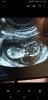 Screenshot_20191213-194338_Gallery.jpg