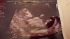 IMG-20191220-WA0003.jpeg