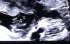1C6AD781-1FC4-4179-9110-06F35DB19531.jpeg