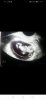 Screenshot_20200114_114958_com.facebook.katana.jpg