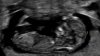 D5BE58FF-381C-4522-B7BC-B33EA0F68548.jpeg