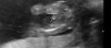 echobaby.jpg