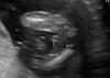 echobaby2.jpg
