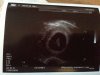 echo 7wk5dgn.jpg