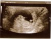 11w2decho.2.jpg