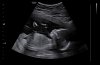BABY_0002-01.jpeg