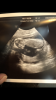 DD788534-8EE1-4F38-9B16-57313DE16491.png