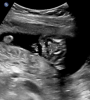 upload_2020-3-7_9-5-1.png