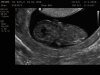 2594377_TIL VAN_20200317_112820_0008.jpg