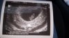 IMG-20200319-WA0021.jpeg