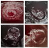 Bildschirmfoto 2020-04-02 um 13.45.59.png