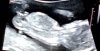 20200415_210820.jpg