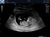 J200060_2959008_Echo.Jpg