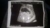 IMG-20200428-WA0022.jpeg