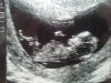 baby2.jpg