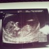 Echo 11w5d.jpg