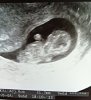 9w6d echo verkleind.jpg