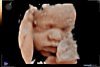 20191128_103351_Baby Simons_202005160039.jpg
