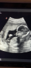 0121412D-70F5-4DE0-B322-776107884CB2.png