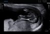 BABY_0008.JPG