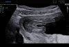 BABY_0012.JPG