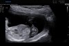 BABY_0011.JPG