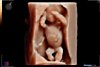 20200608_191325_Baby van Winden_202006080040.jpg