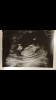 EB662172-7102-4673-99AA-F7DAA846286A.png