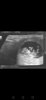 Screenshot_20200618_221959_com.android.gallery3d.jpg