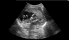 16456_2020-06-24_14.32_142710852.png