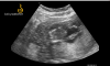 6931DF89-2E1C-4F8E-B2FC-D2955640B156.png
