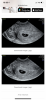 3AECCFFD-74F6-460E-AD64-5CFBC8F4FCA7.png