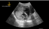 16456_2020-07-07_11.41_113732634.png