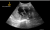 16456_2020-07-07_11.41_112738935.png