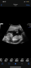 380BAB72-751F-4C1F-ABEC-B8E31F1F434D.png