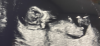 E9CA2032-44FA-488E-8FFD-0E41ED226B5D.png