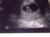 echo 25-3-13.jpg