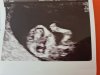 20200831_170625.jpg