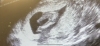 B0063322-59AE-4A9A-A3F5-6EB05A9C99C5.png