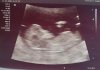 Echo2 - 12wk.jpg