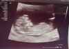 Echo1 - 12wk.jpg
