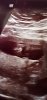 Screenshot_20200906-101521_Gallery.jpg