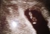 IMG_20200918_210616.jpg