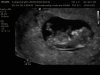 IMG-20201002-WA0022.jpg