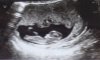 721AD962-30F3-4A7C-8A67-61900D0E4184.jpeg