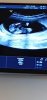Screenshot_20201017-014101_Video Player.jpg