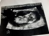 baby.jpg