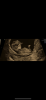 BFC3771F-5170-4A52-BE1D-BF82A46AB378.png